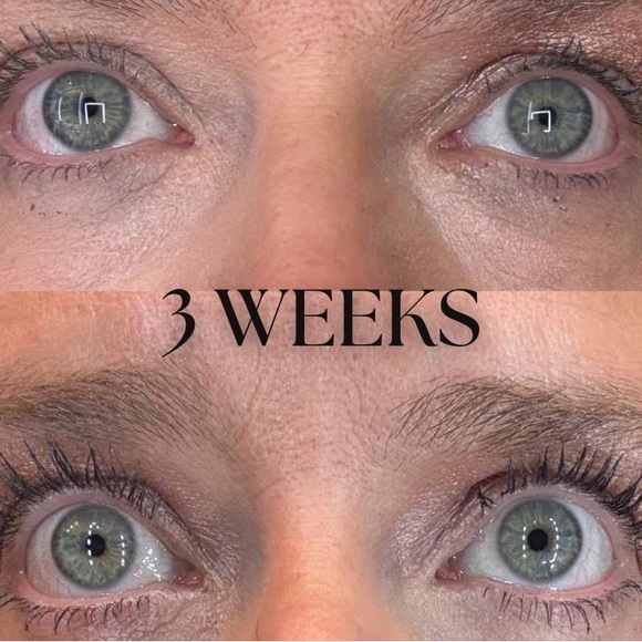Eyelash Growth Serum Results - Picture 5 of 8